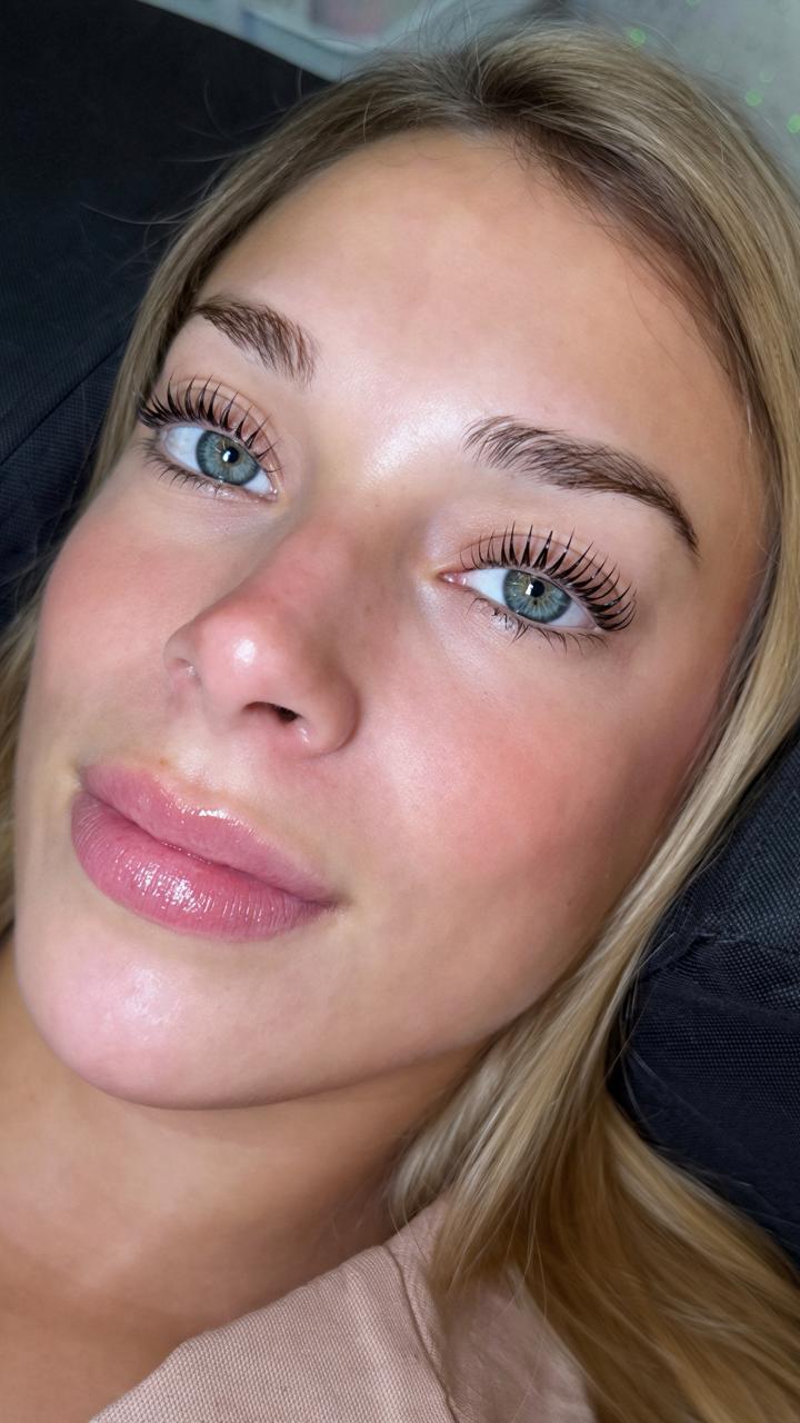 Lifting coreano — curvatura perfecta